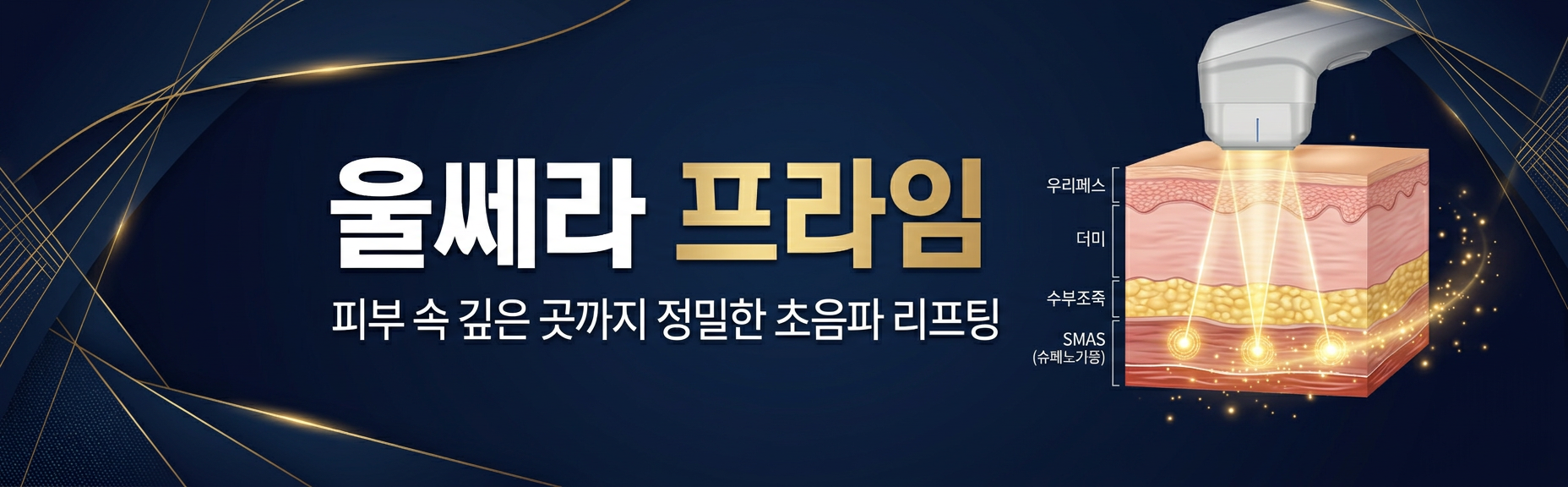 울쎄라 프라임